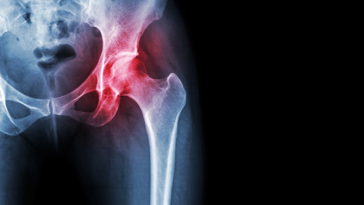Rheumatology